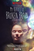 My Beautiful Broken Brain movie poster (2016) Poster MOV_rcbnl8ju